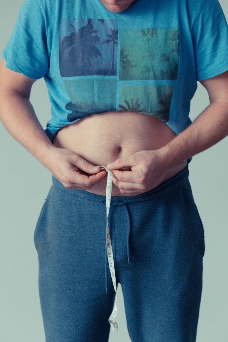 Obezite nedir