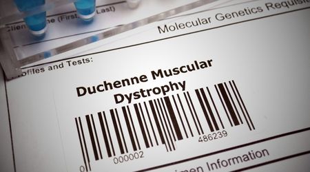 duchenne kas distrofisi nedir