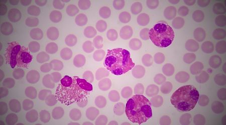 Eozinofilik gastroenteritin nedenleri