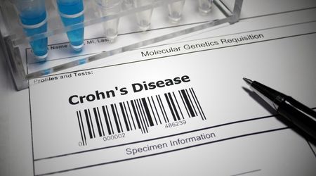Crohn hastalığı nedir