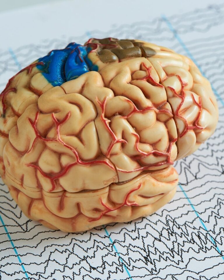 Epilepsi Nedir? Neden Olur? Epilepsinin 9 Belirtisi?