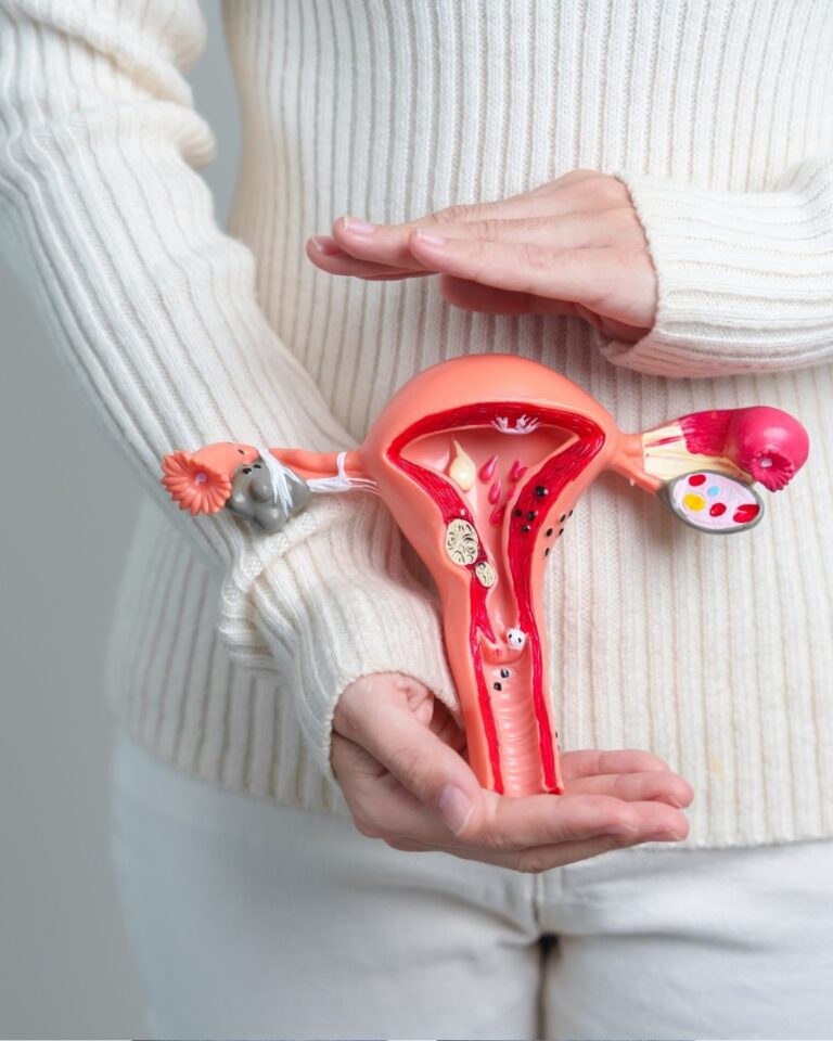 Polikistik Over Sendromu (PCOS) Nedir?