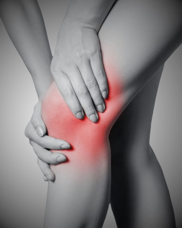 Romatoid Artrit (İltihaplı Romatizma) Nedir?