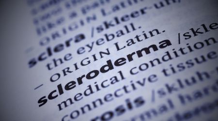 Skleroderma nedir