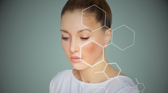 xeroderma pigmentosum