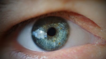Myastenia Gravis nedir