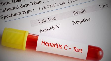 Hepatit C nasıl bulaşır