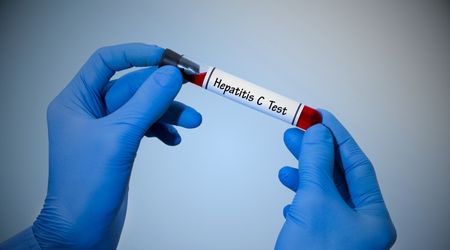 Hepatit C nedir