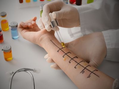 besin duyarlılığı testi nasıl yapılır