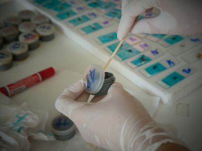 dışkı testleriyle neler anlaşılır