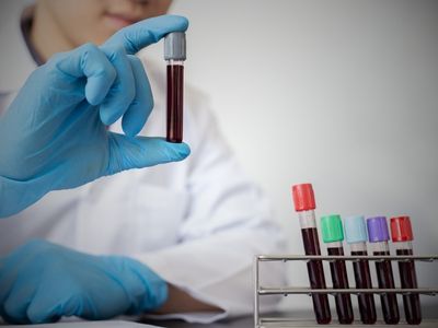 hücresel vitamin-mineral testi nedir