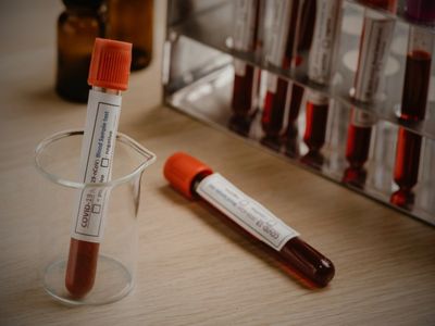 tam kan tahlilinde dikkat edilmesi gereken temel parametreler